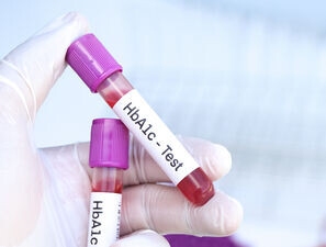 Bild zu Kooperation: KLD - HbA1c-Messergebnisse mit einer weiteren Dezimalstelle angeben?